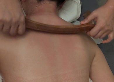 Traditional Gua Sha therapy at Wellness TCM Spa, Singapore, SG. Experience rejuvenation and relief.