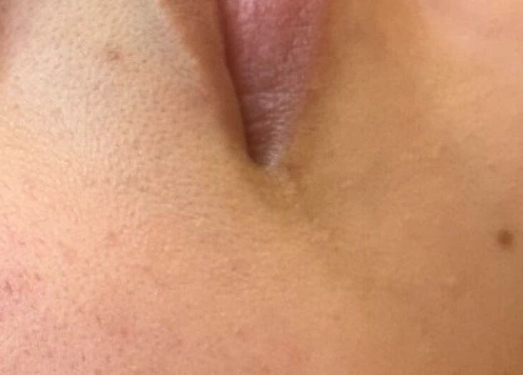 Close-up of smooth skin care result at Face Essence Studio, Novato, California, US.