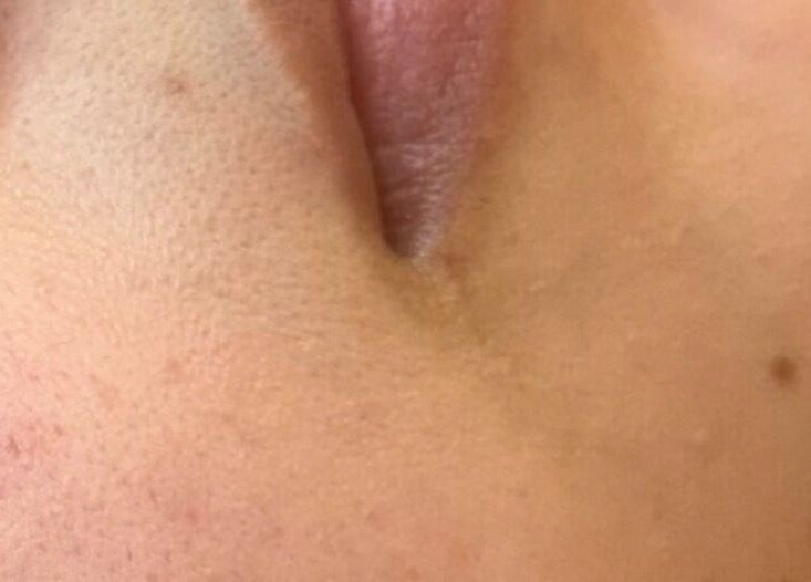 Close-up of smooth skin care result at Face Essence Studio, Novato, California, US.