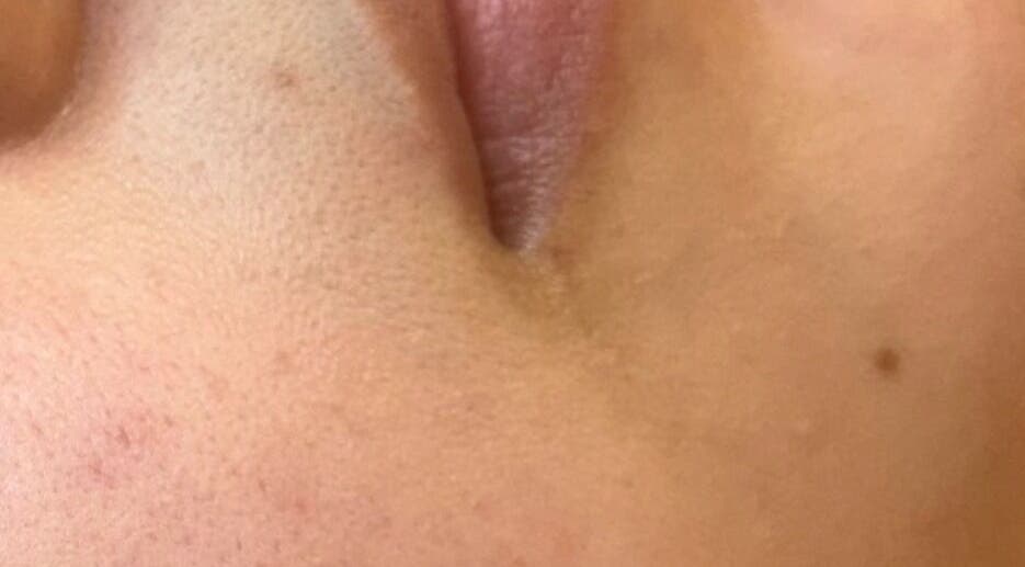 Close-up of smooth skin care result at Face Essence Studio, Novato, California, US.