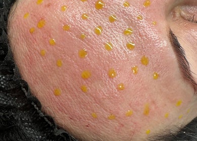 Close-up of a facial treatment with yellow drops at Jolanta Palka in Witney, England, GB.
