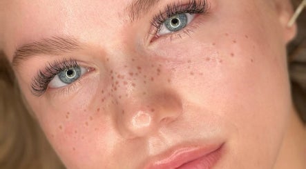 Freckles by Lia