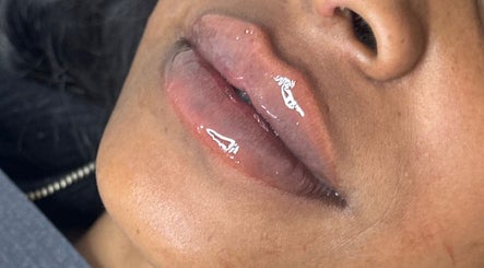Close-up of glossy lips treatment at Boss Babe Beauty And Aesthetics, London, England, GB.