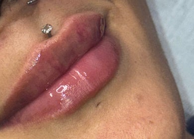 Close-up of glossy lips service at Boss Babe Beauty And Aesthetics, London, England, GB.