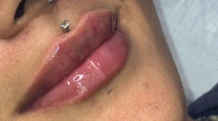 Close-up of glossy lips service at Boss Babe Beauty And Aesthetics, London, England, GB.