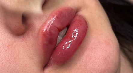 Glossy lips showcased at Boss Babe Beauty And Aesthetics, London, England, GB.