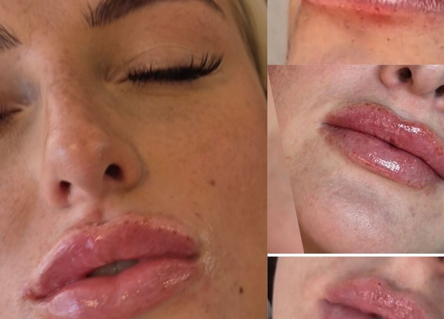 Close-up of lip enhancement results at Aesthetics by Lyssa in Rhyl, Wales, GB, showcasing glossy, fuller lips.