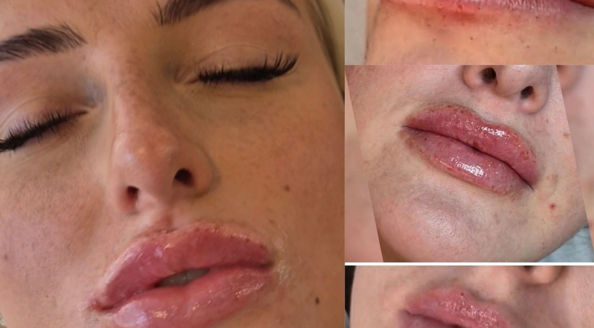 Close-up of lip enhancement results at Aesthetics by Lyssa in Rhyl, Wales, GB, showcasing glossy, fuller lips.