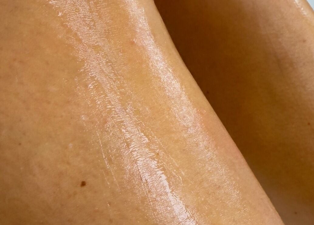 Smooth, radiant skin treated at Laser by Lucy, Southend-on-sea, England, GB.