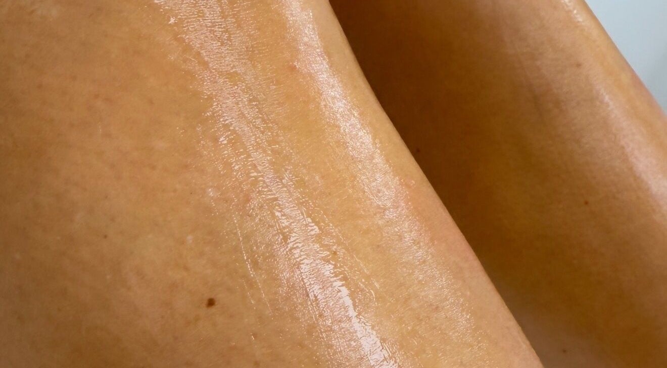 Smooth, radiant skin treated at Laser by Lucy, Southend-on-sea, England, GB.