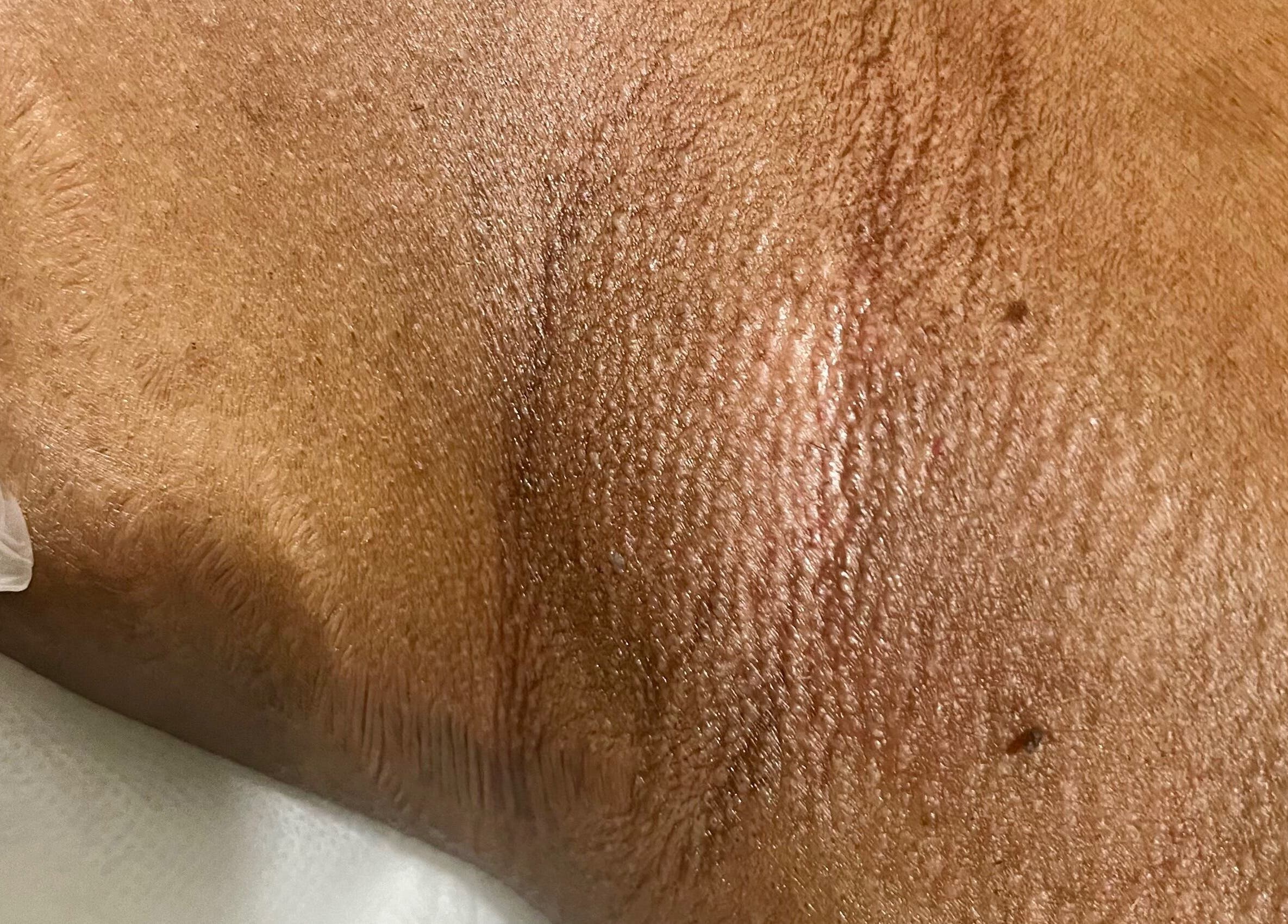 Close-up of treatment-ready skin at Pretty's, Bellbird Park, Queensland, AU, featuring texture and hydration.