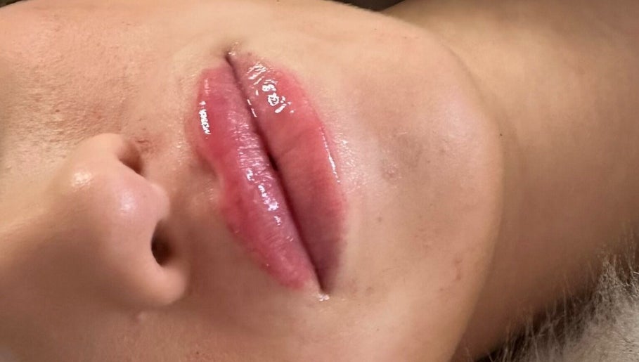 Close-up of glossy lips at Lips&Lines in Dublin, County Dublin, IE, showcasing expert beauty enhancement.