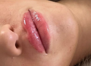 Close-up of glossy lips at Lips&Lines in Dublin, County Dublin, IE, showcasing expert beauty enhancement.