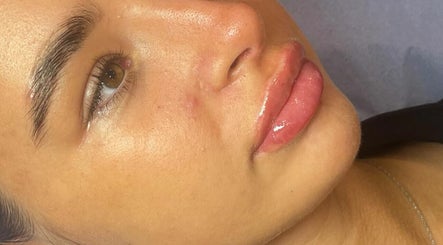 Close-up of radiant skin and enhanced lips at Lips&Lines, Dublin, County Dublin, IE.