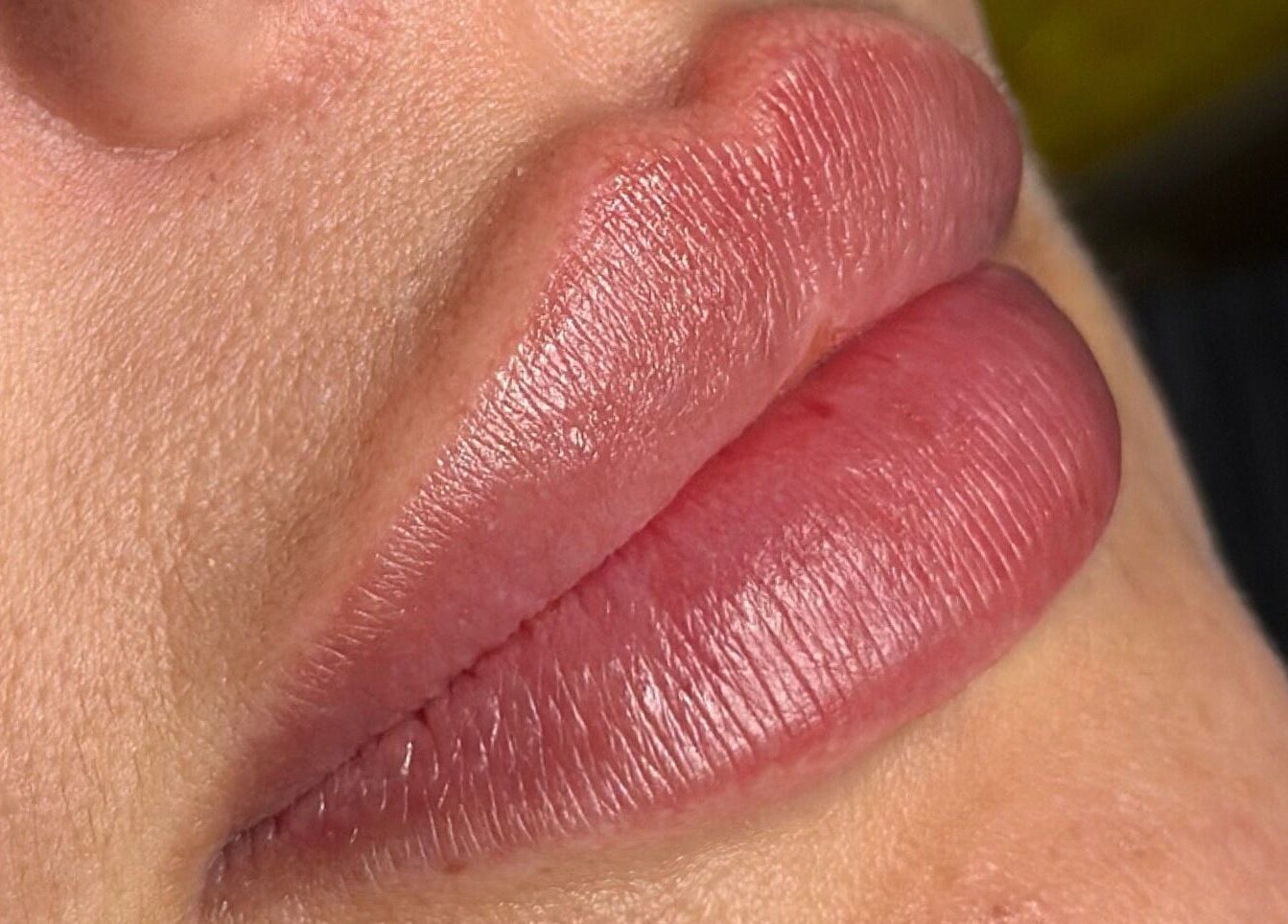 Close-up of enhanced lips at Julia Clark Aesthetics & Academy, Redbourn, England, GB.