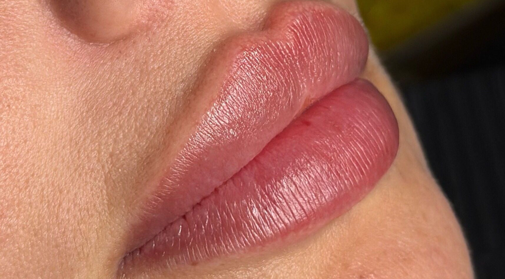 Close-up of enhanced lips at Julia Clark Aesthetics & Academy, Redbourn, England, GB.