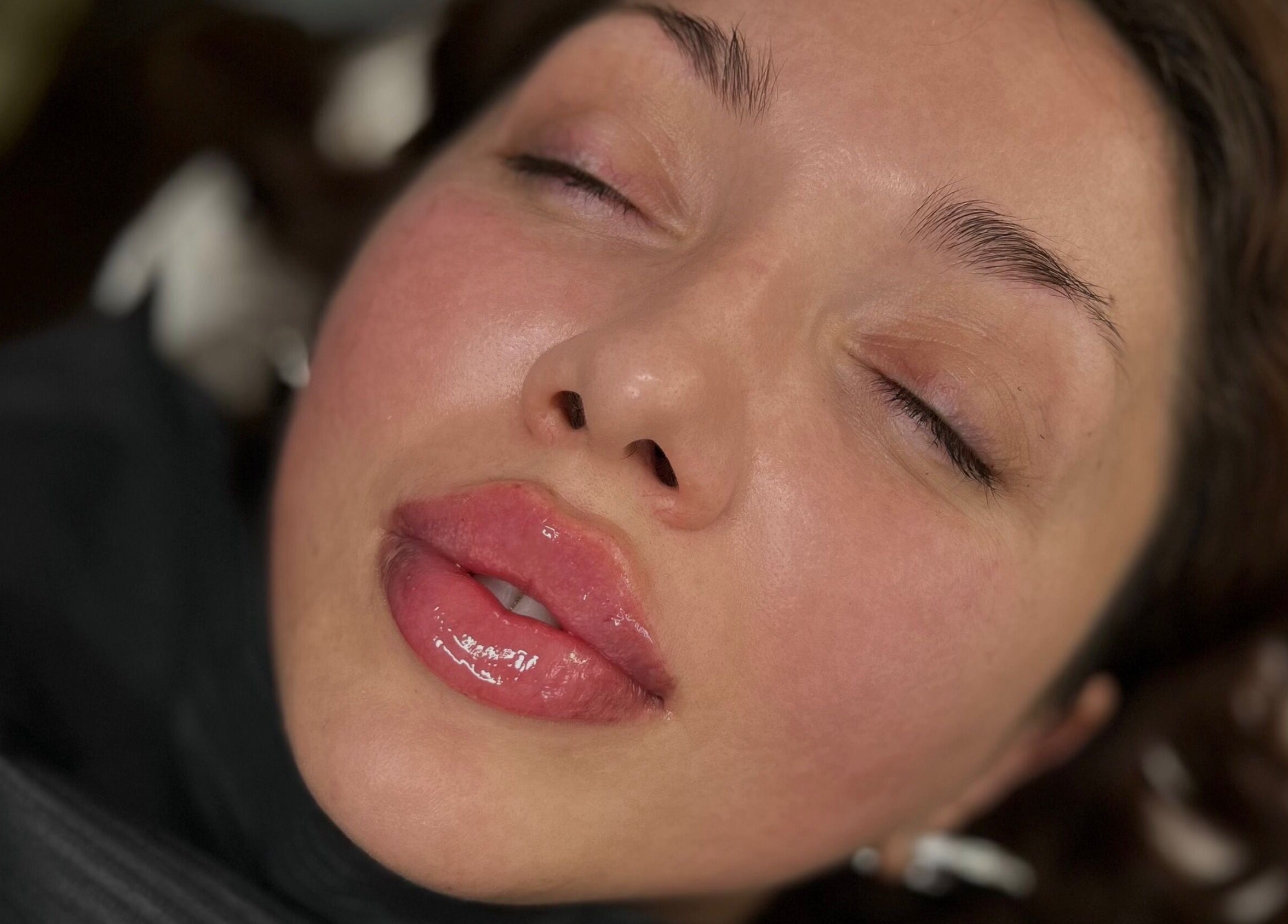Close-up of glossy lips after treatment at Julia Clark Aesthetics & Academy, Redbourn, England, GB.