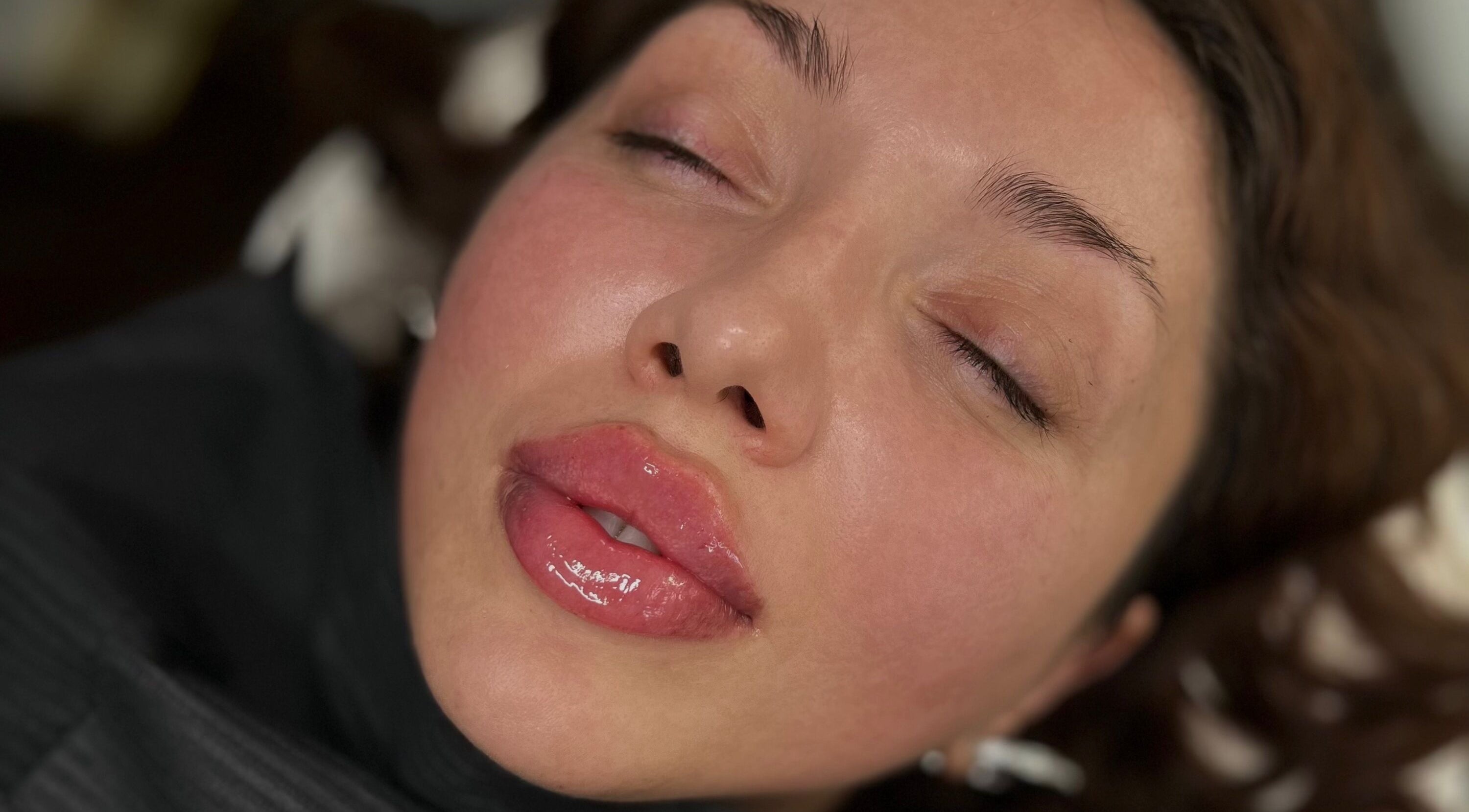 Close-up of glossy lips after treatment at Julia Clark Aesthetics & Academy, Redbourn, England, GB.