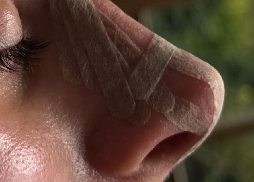 Close-up of skin treatment at Julia Clark Aesthetics & Academy in Redbourn, England, GB, highlighting wellness care.