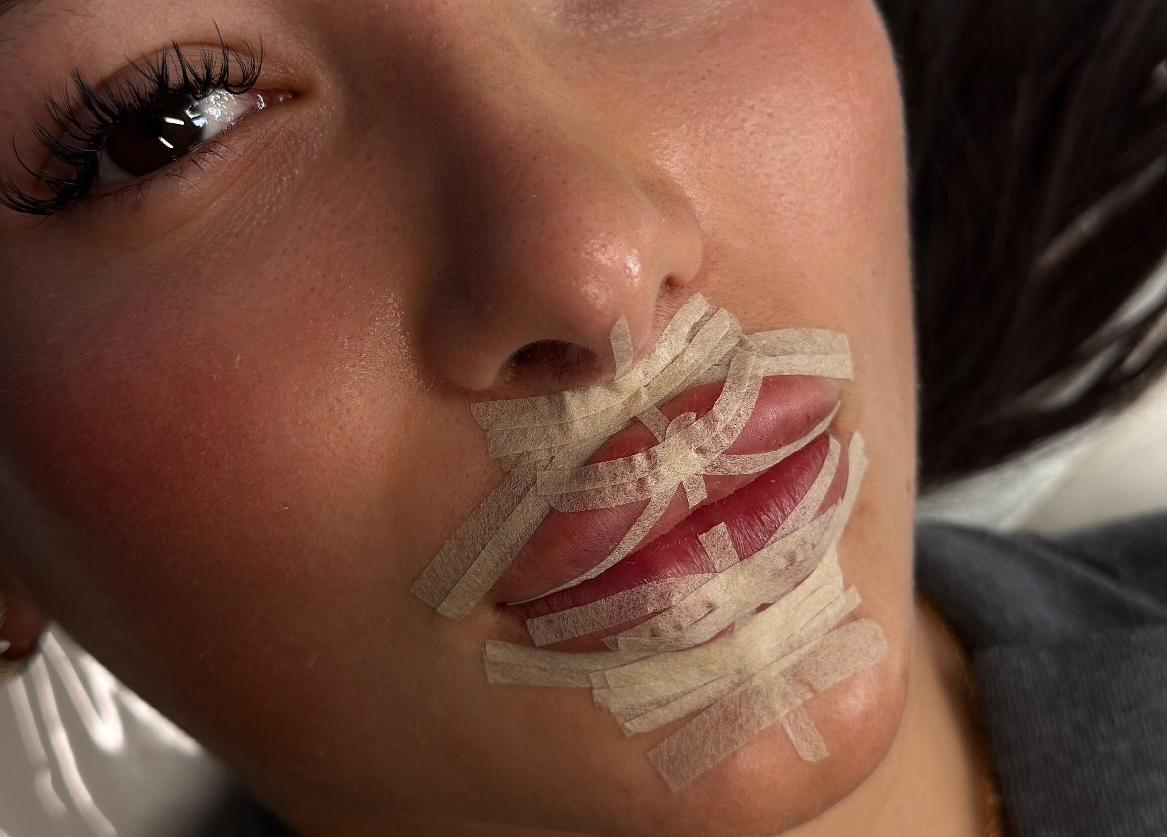 Creative lip treatment at Julia Clark Aesthetics & Academy, Redbourn, England, GB showcasing unique beauty care.