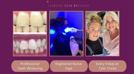 Blanc Cosmetic Teeth whitening