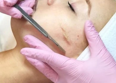 Dermaplaning at Piko’s Skin Care, Sarasota, Florida, US enhances skin texture and glow.