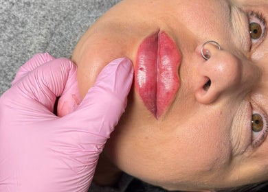 Lips enhancement at Shine By S, Peterborough, England, GB with pink-gloved hand enhancing results.