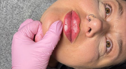 Lips enhancement at Shine By S, Peterborough, England, GB with pink-gloved hand enhancing results.