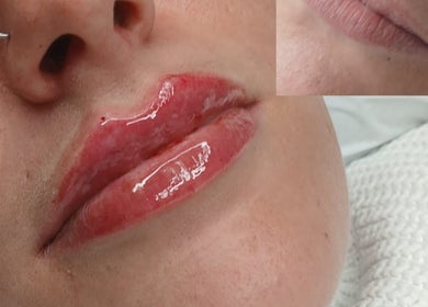 Lip gloss enhancement at Shine By S, Peterborough, England, GB.