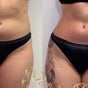 Calm Escape Body Sculpting Spa - Private, Brays Oaks, Houston, Texas