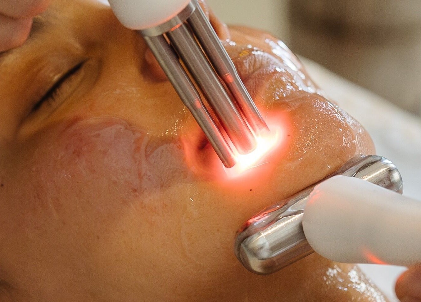 Advanced laser facial treatment at Alchemy Spa, Valletta, MT, enhancing skin glow and vitality.