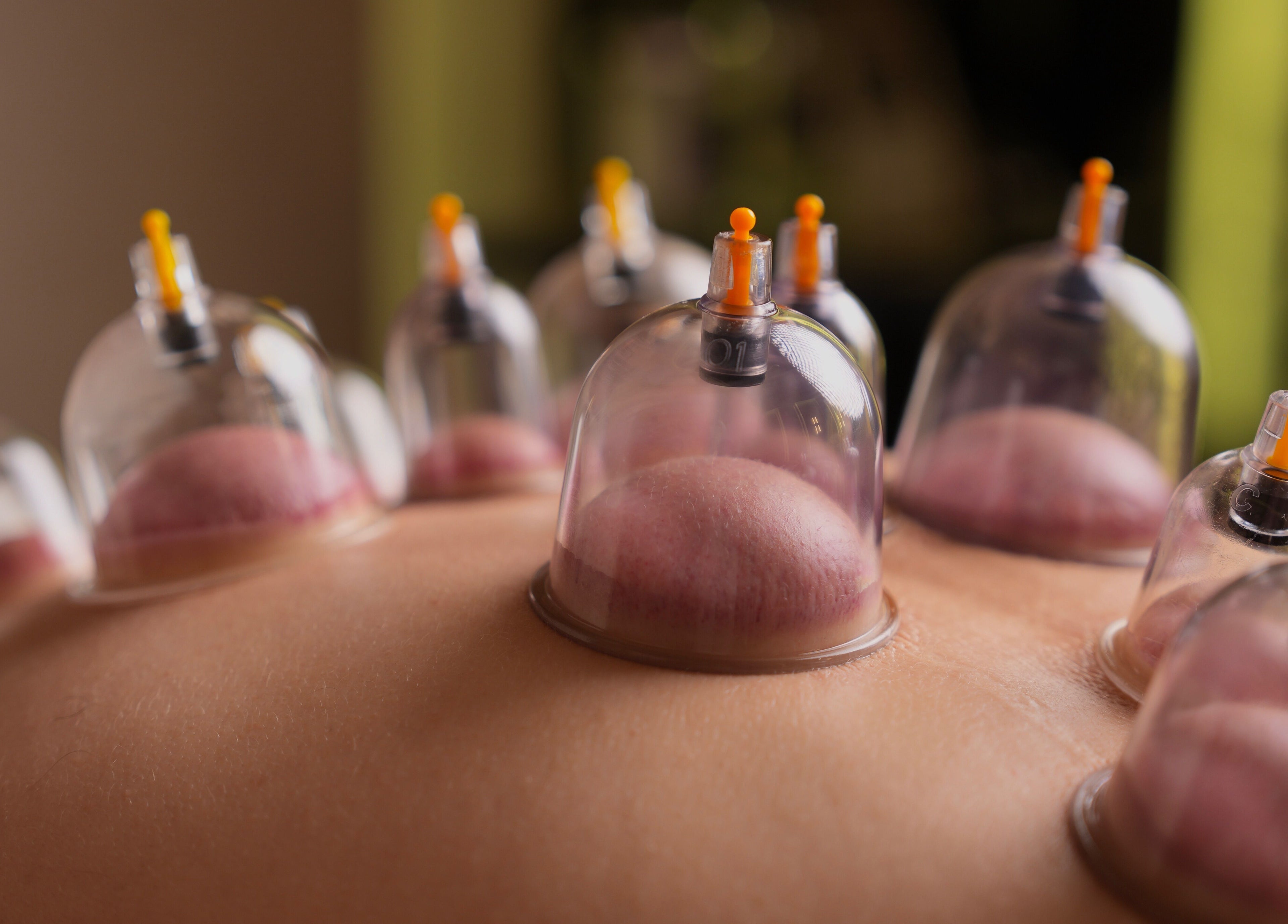 Cupping therapy session at Generation Gentleman Barbershop, دبي, دبي, AE promoting relaxation and wellness.