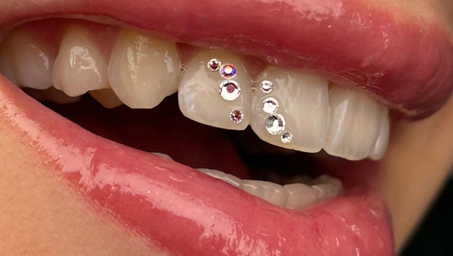 STORM PIERCING & TOOTH GEMS – kuva 1