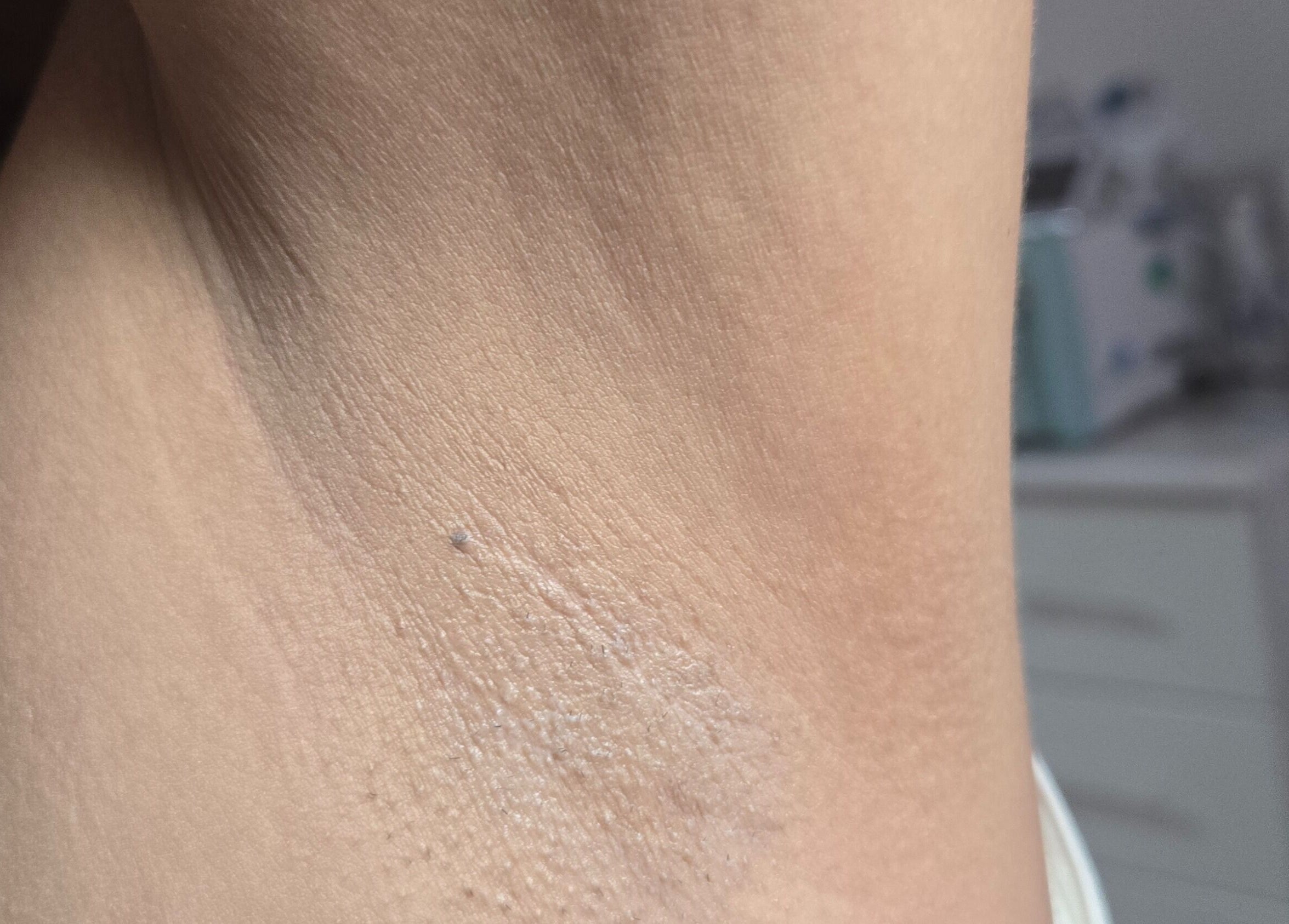 Primer plano de la piel suave después de tratamiento en Depila2, Willemstad, CW.