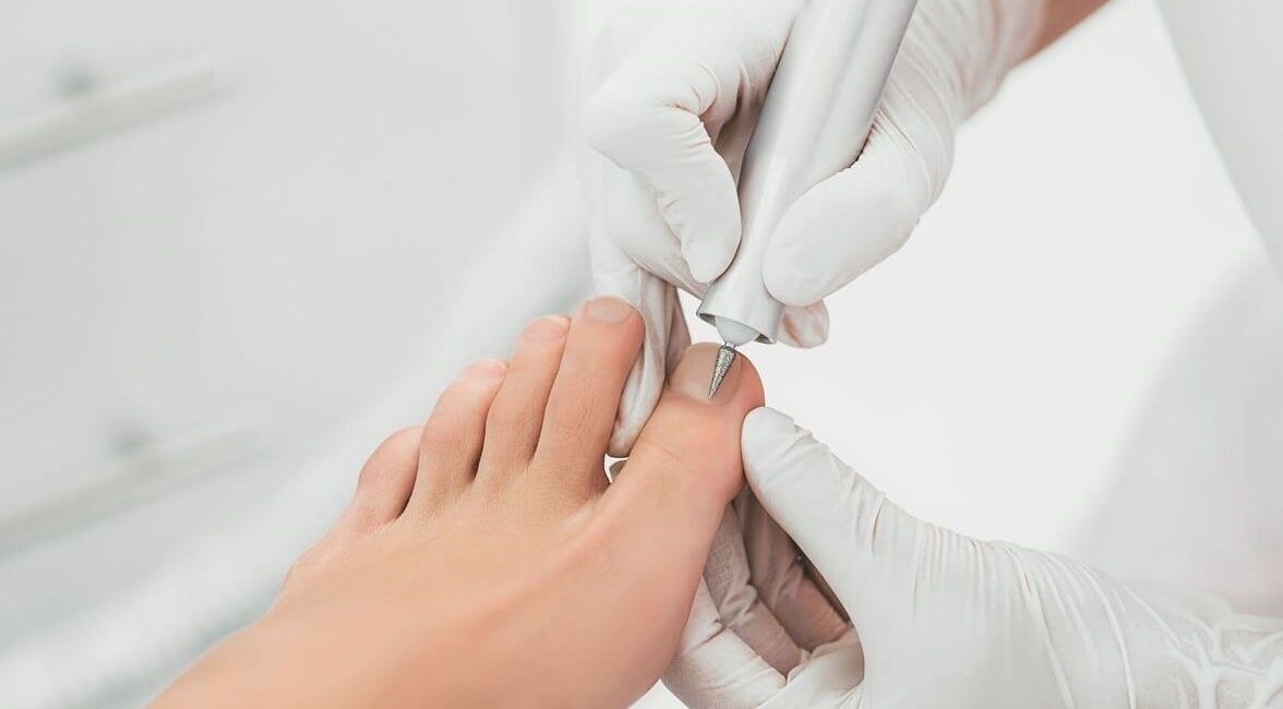 Expert foot care at Medi Nail Pro, Hong Kong, HK, providing precise nail treatment for healthy toes.
