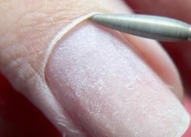 Close-up of nail grooming at Medi Nail Pro, Hong Kong, HK, showcasing precise manicure technique.