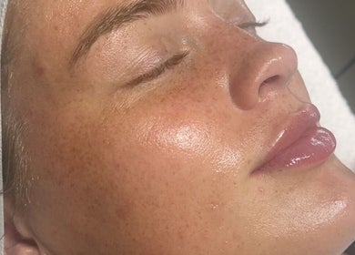 Close-up of a glowing skin facial treatment at ForEva Skin, Wishaw, Scotland, GB.