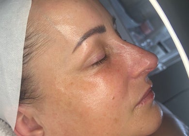 Close-up of a serene woman's face during facial treatment at ForEva Skin, Wishaw, Scotland, GB.