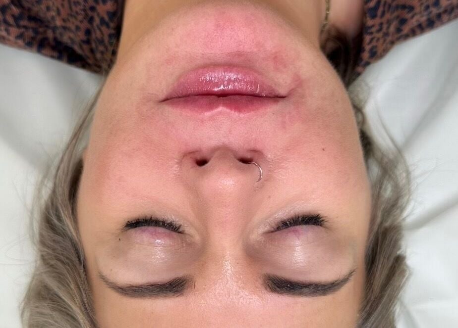Close-up of a relaxed face during a treatment at OMORFIA Medi Aesthetics Tiverton, Bolham, England, GB.