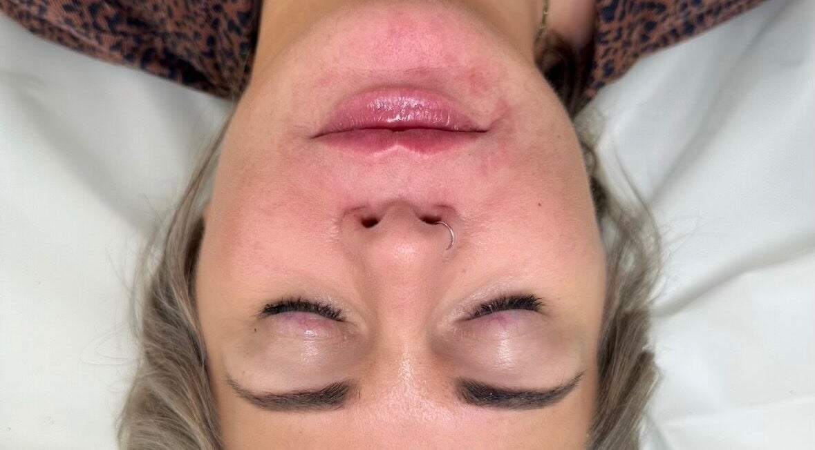Close-up of a relaxed face during a treatment at OMORFIA Medi Aesthetics Tiverton, Bolham, England, GB.