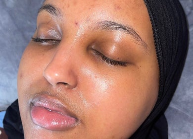 Close-up of a relaxed woman's face post-treatment at Muniira's Clinic, London, England, GB.