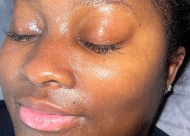 Close-up of a glowing face after treatment at Muniira's Clinic, London, England, GB.