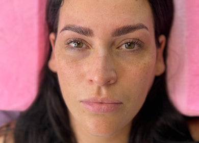 Close-up of a client after treatment at The Lab Studio, Randwick, New South Wales, AU, highlighting flawless skin.