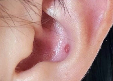 Détail d'une oreille pour art corporel chez Au.tattoon, Valleiry, Auvergne-rhône-alpes, FR.