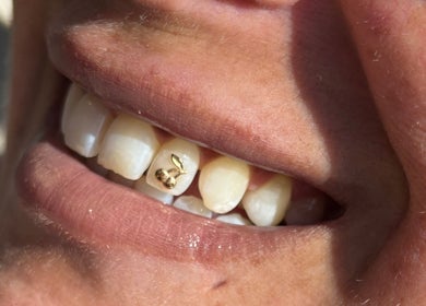 Close-up of gold tooth gem in vibrant smile at Lash + Headspa Suite, Fort Erie, Ontario, CA.