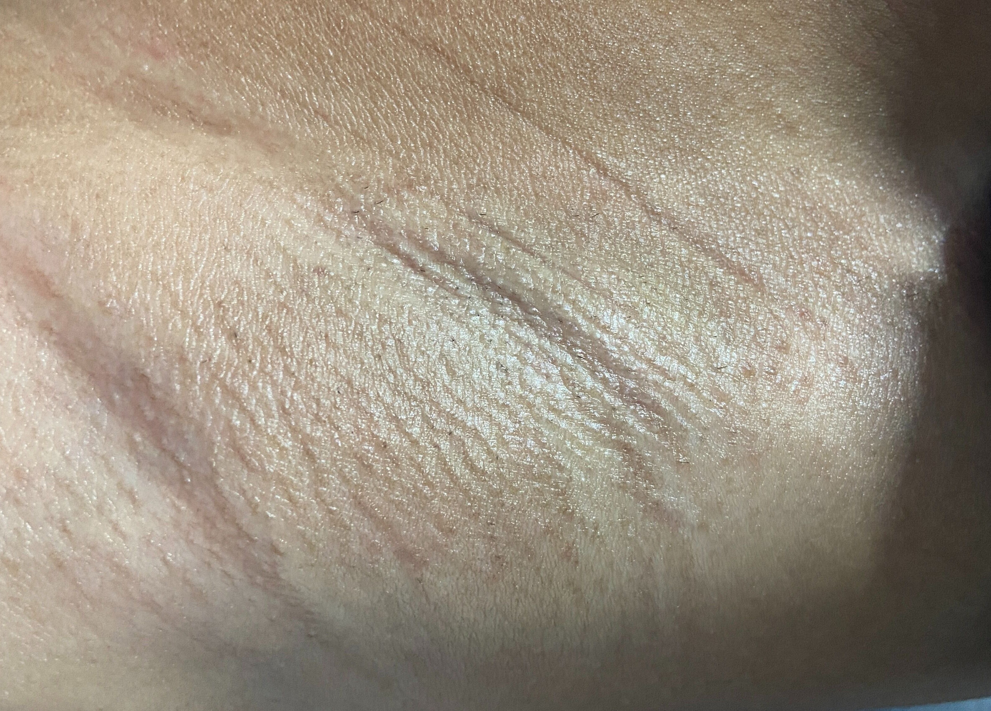 Close-up of smooth skin after waxing at SkinByTrace Waxing and Body Care, Kingston, St. Andrew Parish, JM.