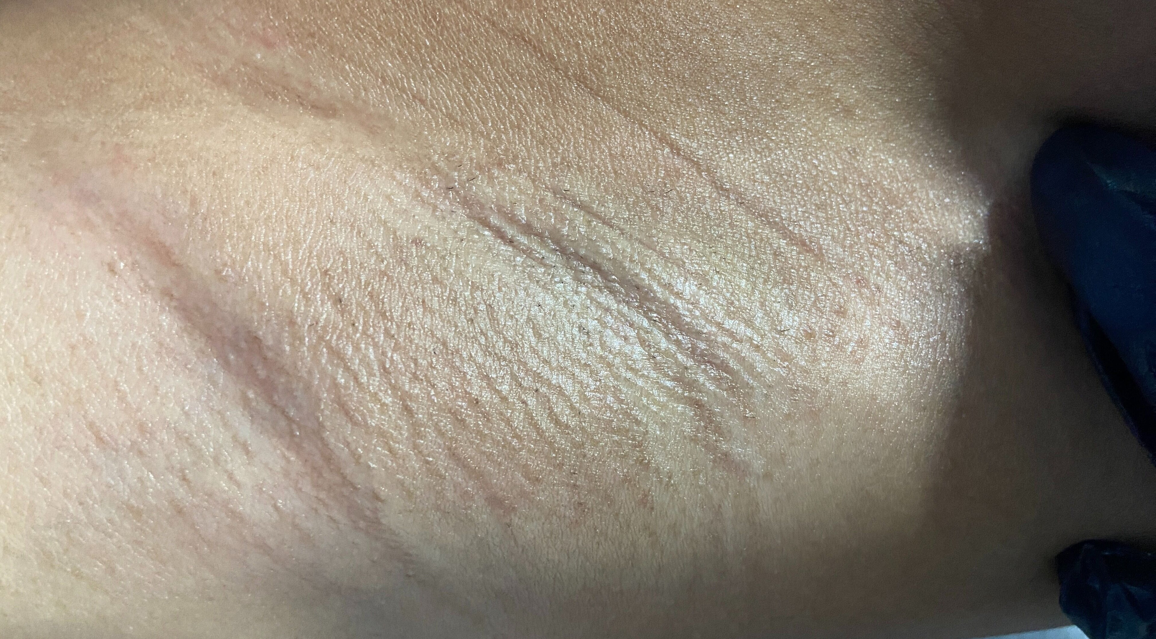 Close-up of smooth skin after waxing at SkinByTrace Waxing and Body Care, Kingston, St. Andrew Parish, JM.