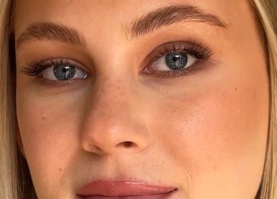 Close-up of radiant skin care result at Glos Skin & Beauty in Helensvale, Queensland, AU.