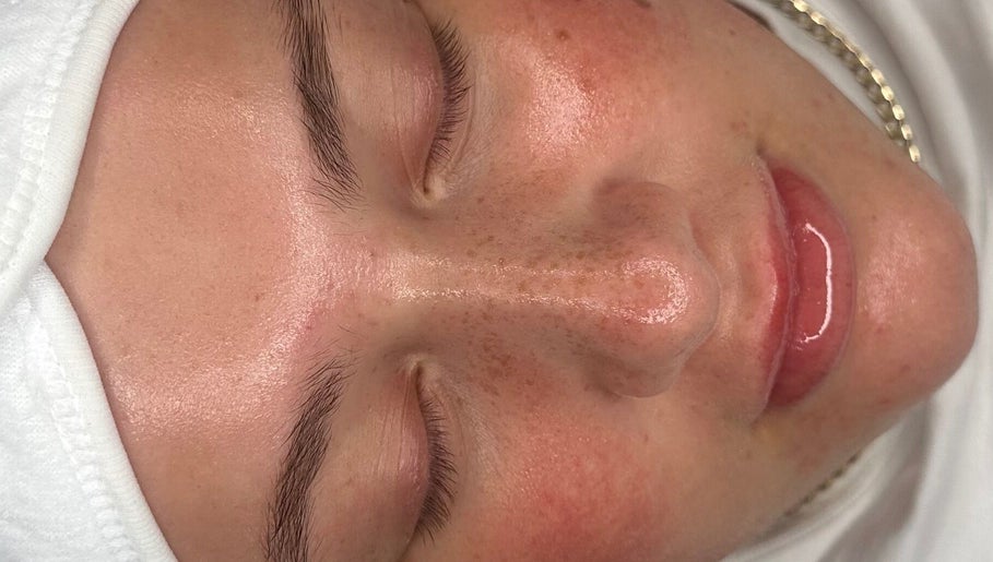Close-up of a glowing face after a treatment at Sofia’s Skin Space, Louth, England, GB.
