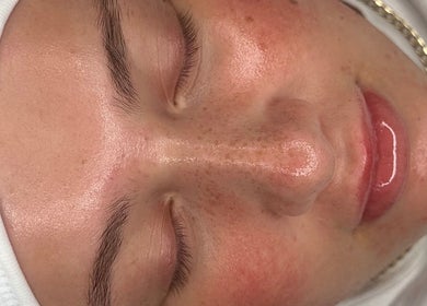 Close-up of a glowing face after a treatment at Sofia’s Skin Space, Louth, England, GB.